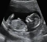 Mabel Catalina Salazar