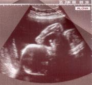 Martha Liliana  Noss Amaya